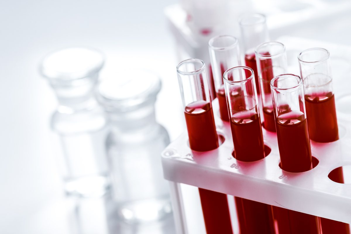 glass tubes with blood sample in stand no one