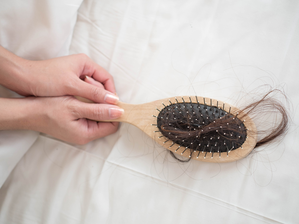 Hair,Loss,Problem
