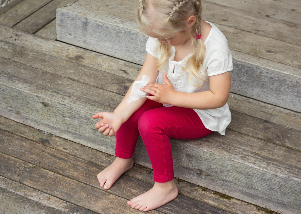 Girl,Applying,Cream,On,Allergic,Skin,,Eczema,Treatment