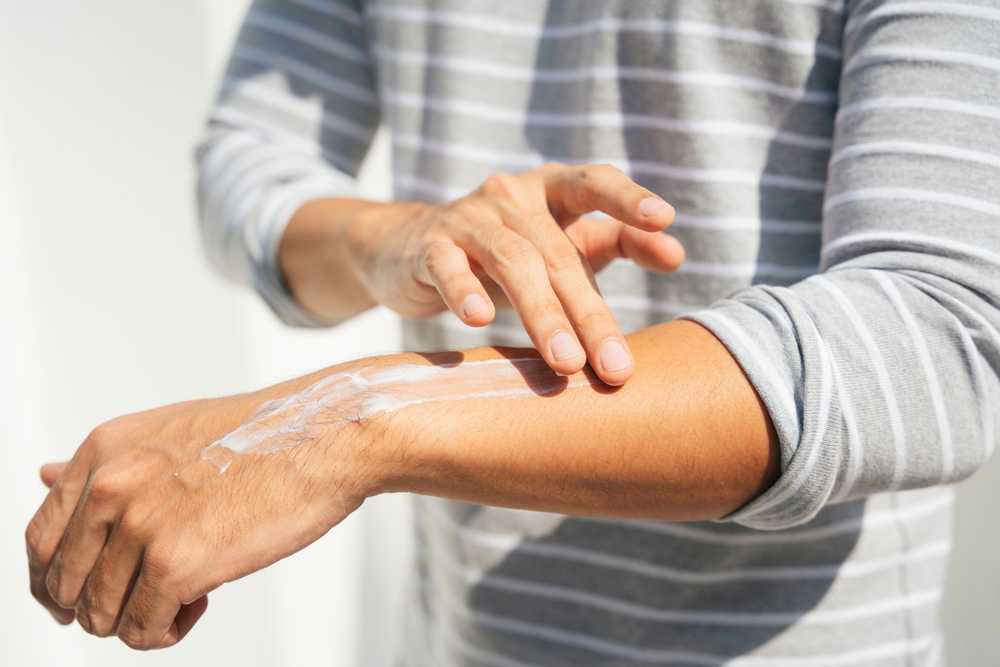 Hand,Of,A,Man,Applying,Cream,Lotion,On,Arms,To