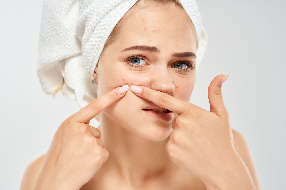 Woman,Squeezes,Acne,On,The,Face,Of,Beauty