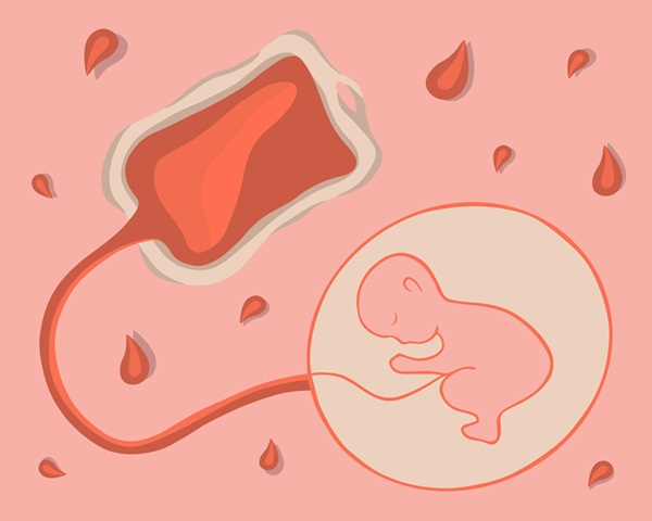 Umbilical cord blood.