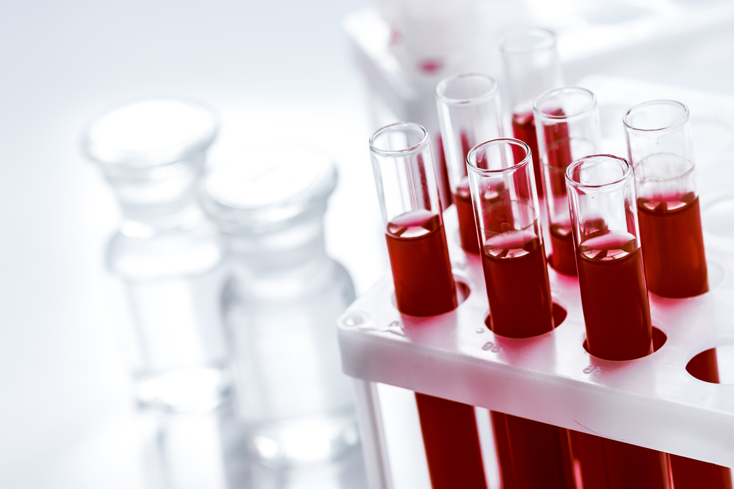 glass tubes with blood sample in stand no one