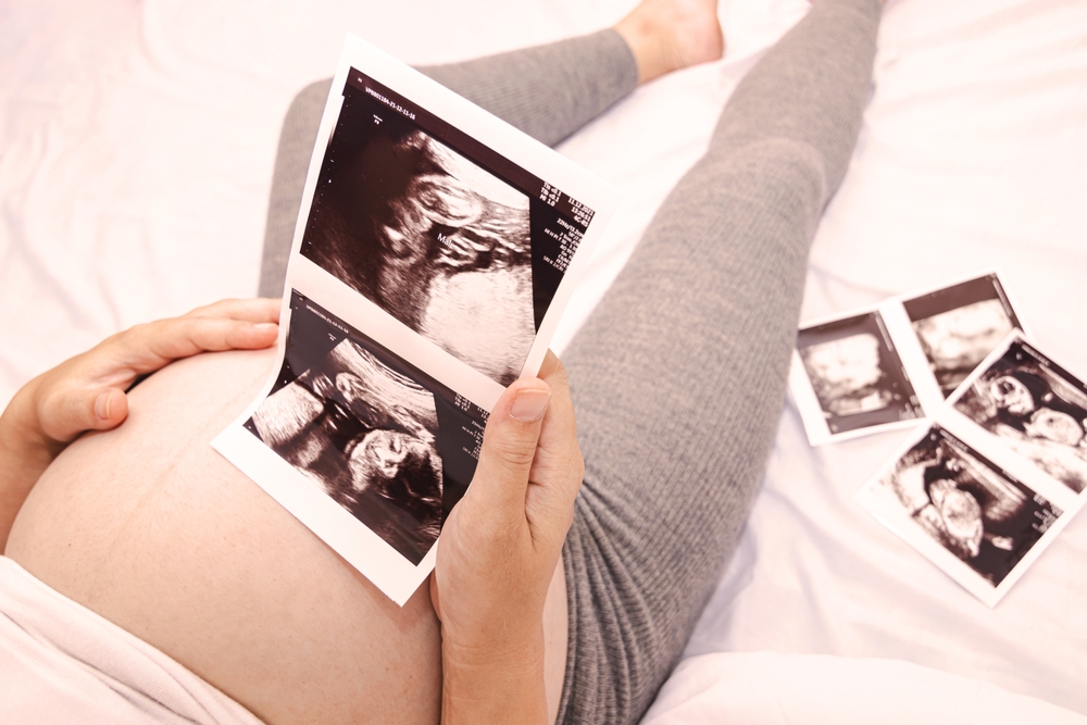 Close-up,Of,A,Pregnant,Woman,Holding,An,Ultrasound,Scan.,Pregnant